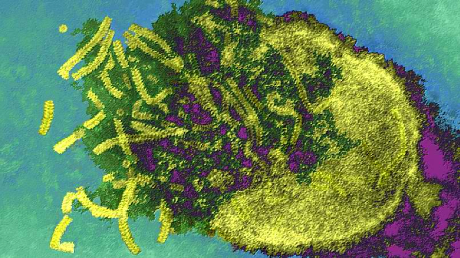 Cancer : une malade en rémission grâce au virus de la rougeole
