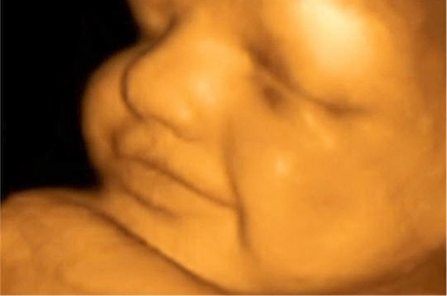 Echographies 3D, des risques de séquelles pour votre bébé