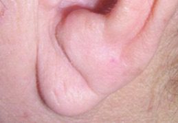 Lire dans les lignes de l’oreille