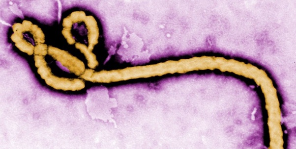 Maladies émergentes : les épidémies sont à nos portes