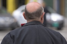 Des dépressions liées à un médicament contre la chute des cheveux