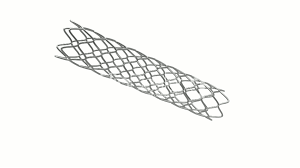 Les stents ne sont pas la panacée universelle