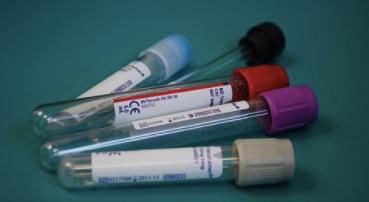 Gamma GT ou la signification d’un bio-marqueur