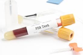 Le dépistage du cancer de la prostate le fameux PSA, ne sauve pas une seule vie
