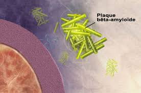 Maladie d’Alzheimer : le virus de l’herpès cause ou solution ?