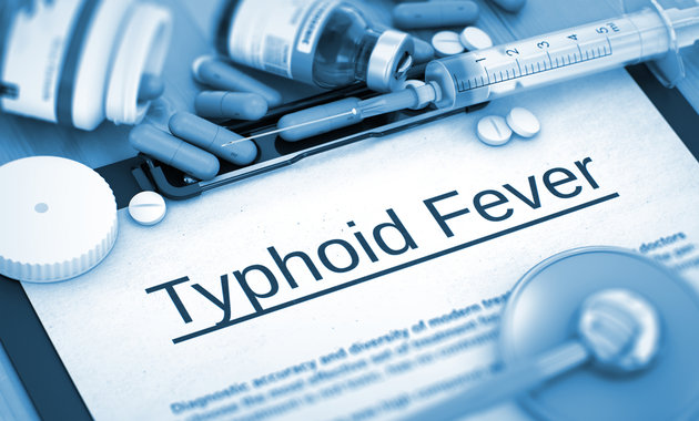 Thyphoid Fever