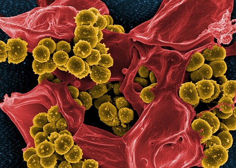 Des bactéries trouvées dans le cerveau
