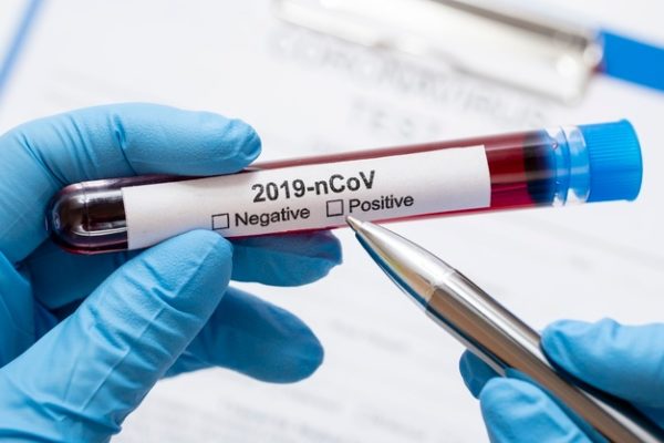 Deux scientifiques lancent un appel au dépistage de la population