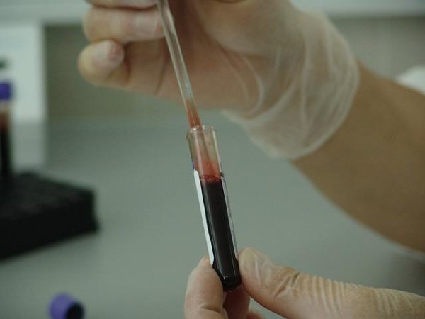 Le SIDA a-t-il vu le jour à cause d’un vaccin anti-polio défectueux? Première partie